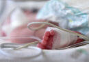 Bebê sofre queimaduras durante banho em creche de SC