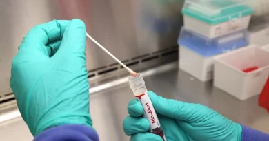 Casos de mpox mais que dobram em 20 dias, com 129 confirmações no Brasil