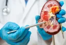 Doença renal avança no país e expõe gargalos de acesso à diagnóstico precoce e à diálise
