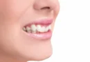 Sorriso desalinhado? Vejas 6 problemas que vão além da saúde bucal