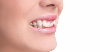 Sorriso desalinhado? Vejas 6 problemas que vão além da saúde bucal