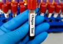 Risco cardíaco dobra para pacientes com doença de Chagas após cirurgia