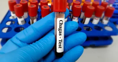 Risco cardíaco dobra para pacientes com doença de Chagas após cirurgia