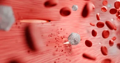 7 hábitos simples para controlar o açúcar no sangue no dia a dia