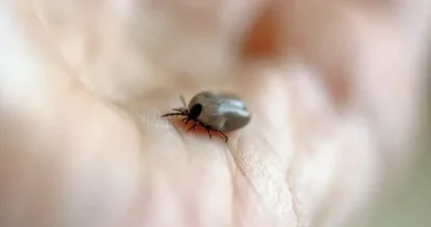 Mulher morre de febre maculosa no ABC; carrapatos foram encontrados em cães da vítima