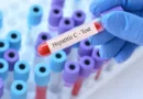 Mortalidade por hepatite viral atinge 1 a cada 5 pacientes com 80 anos no SUS