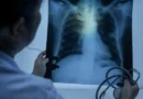 Entenda quando uma infecção respiratória pode evoluir para pneumonia