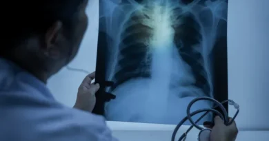 Entenda quando uma infecção respiratória pode evoluir para pneumonia