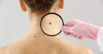 Moderna e Merck anunciam sucesso de vacina experimental com mRNA contra recidiva do melanoma