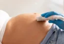 Mulher descobre gravidez um mês após hospital confirmar aborto e fazer curetagem com feto vivo