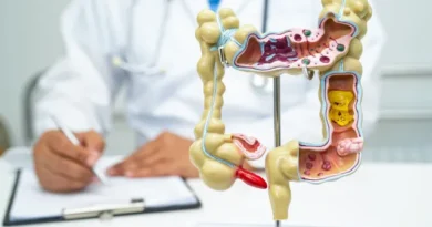 Em 13 anos, doença inflamatória intestinal cresce 5 vezes no Brasil