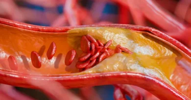 5 alimentos ricos em proteína que também têm muita gordura; veja quais