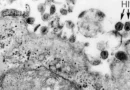 Vírus HTLV-1 causa síndrome inflamatória em assintomáticos, aponta estudo