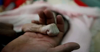 Conflito no Iêmen: ONU aponta recorde de pessoas passando fome